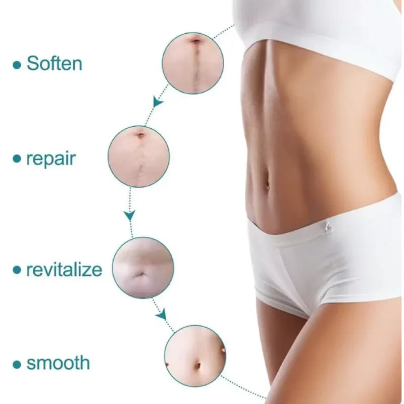 Silicone Scar Strip 4x150cm