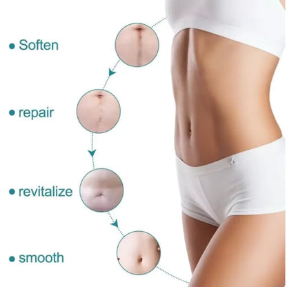 Silicone Scar Strip 4x150cm