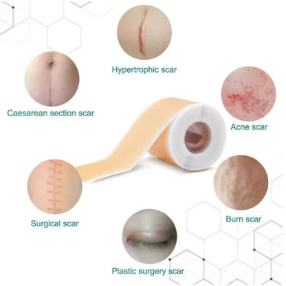 Silicone Scar Strip 4x150cm